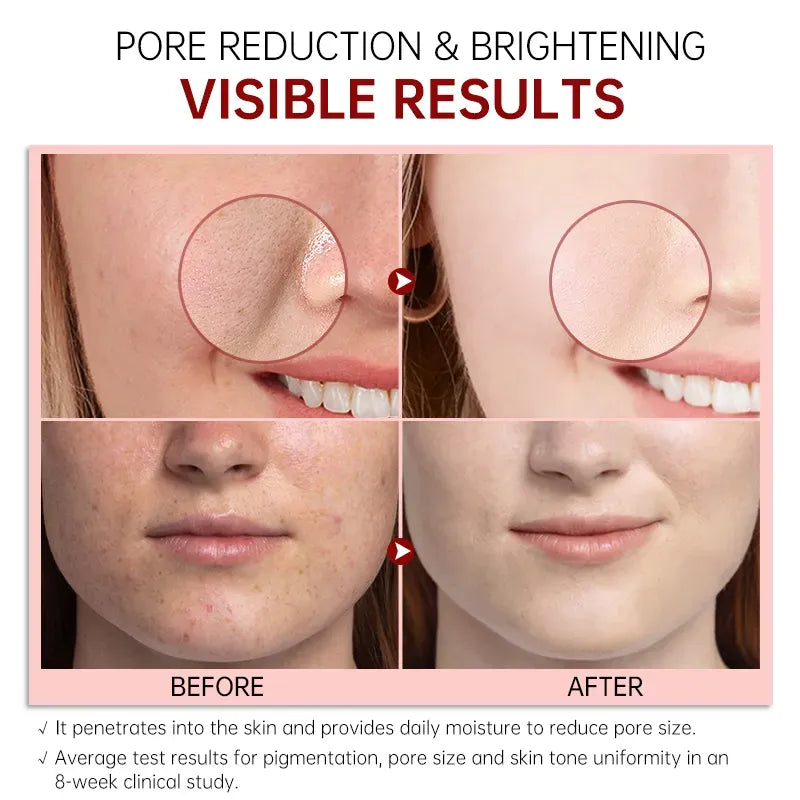 Serum Dark Spot Remover