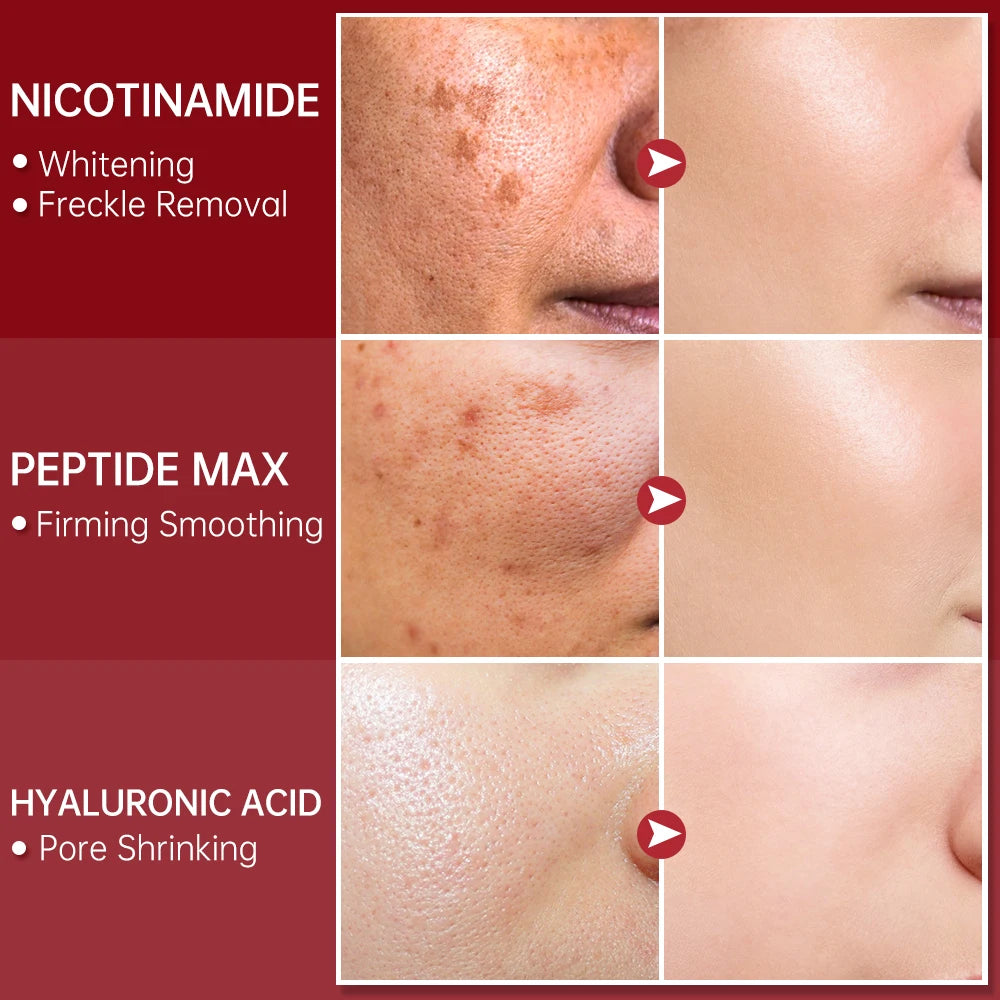 Serum Dark Spot Remover