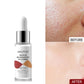Serum Dark Spot Remover