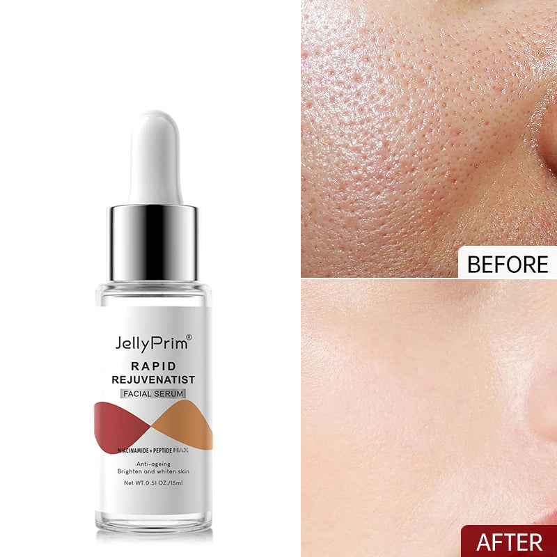 Serum Dark Spot Remover